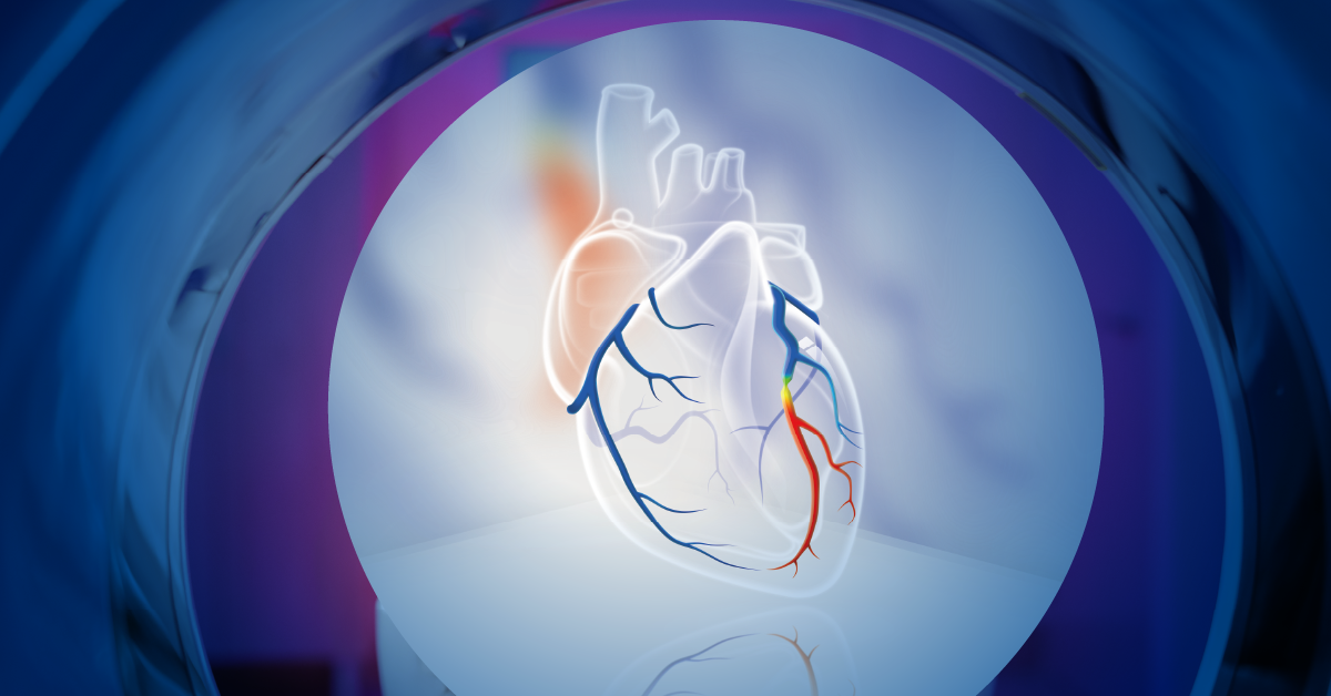 deep-learning-based-ct-ffr-a-gatekeeper-to-the-cath-lab