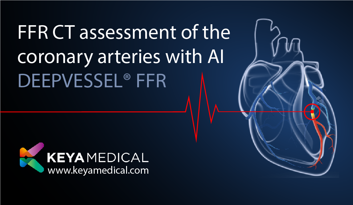 Keya Medical's FFR CT analysis DEEPVESSEL® is now available in the